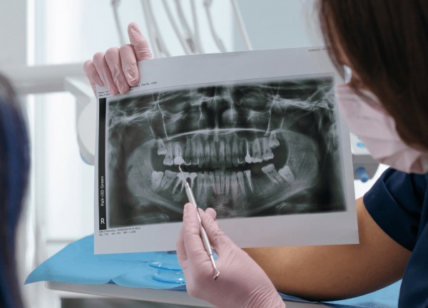 Online-Curriculum Endodontologie